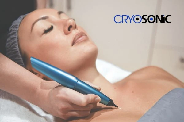 Cryosonic lesion removal prices book today! Haydock