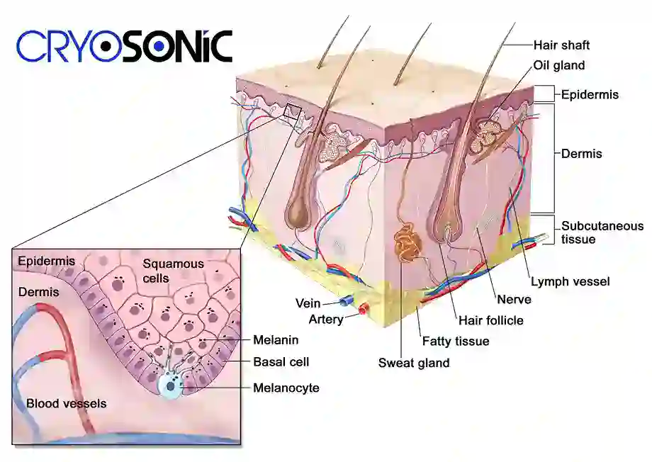 How Cryotherapy Stimulates Melanocyte Activity Haydock